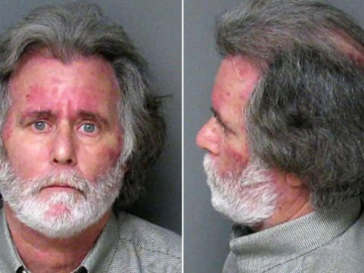 Tumors: Classified as Benign (non-cancerous), Premalignant (potentially cancerous), and Malignant...