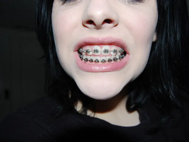 Crest Whitestrips Currently Offer the Lowest Prices of the Year – Temporarily, Though