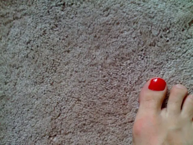 Thigh Numbness: Causes, Signs, and Remedies