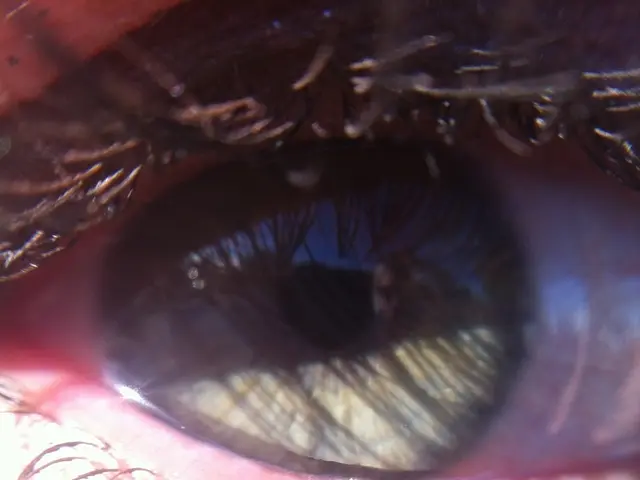 Could One Replace Eye Drops with Contact Solution?