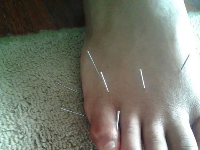 Guide on Self-Examination for Testicular Cancer Detection