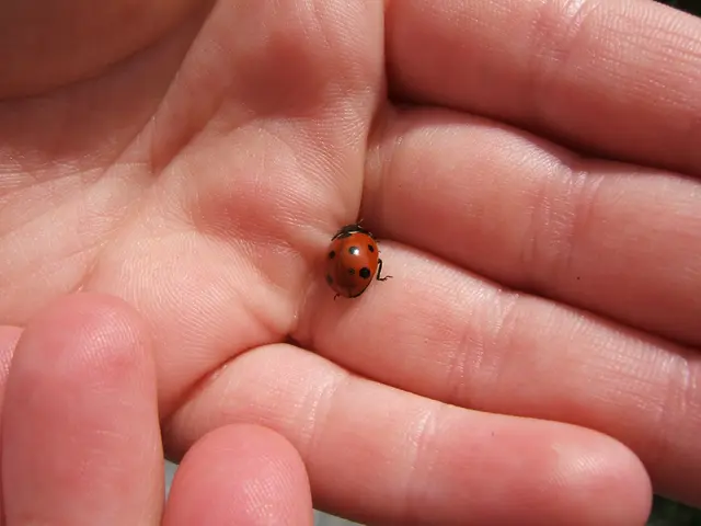 Skin condition characterized by intense peeling of the acral skin, discussed along with identifying...