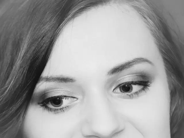 Guide on Minimizing Laughter Wrinkles, Either With or Without Surgical Intervention