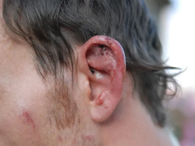 Ear-pulsing ringing (tinnitus) accompanied by anxiety symptoms