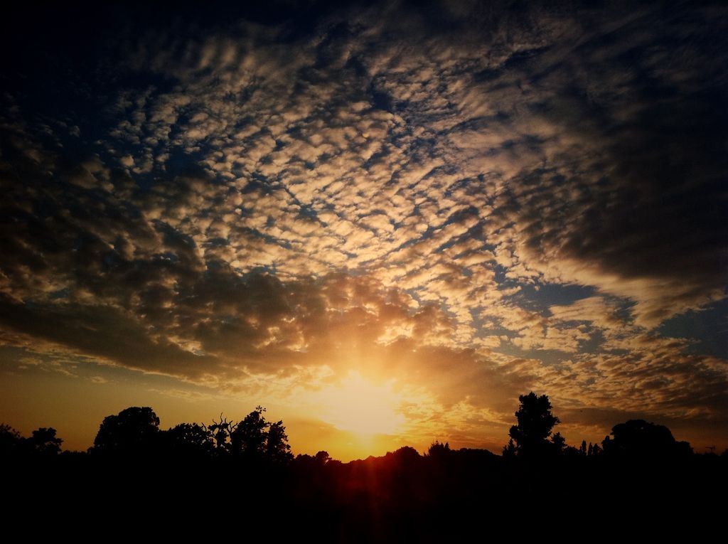 Model Employs Calcium-Based Collagen-Boosting Dermal Filler with High Lift Potential